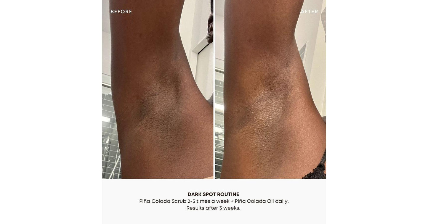 Bushbalm Dark Spot Exfoliating Scrub - Pina Colada (8oz)