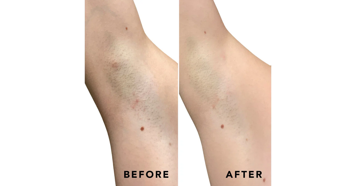 SweetSpot Buff & Brighten Body Exfoliating Pads (50 pads)