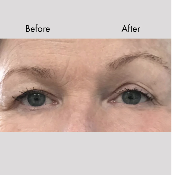 Bring It Up | Instant Face Lift