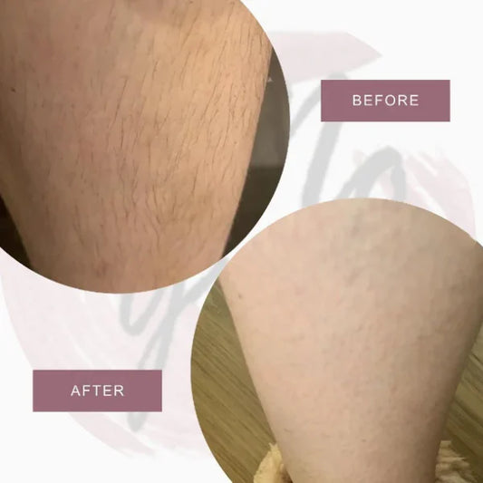 no grow | Female Body Hair Remover & Growth Inhibitor