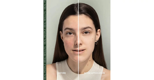 Fitglow Redness Rescue Cream (RRC) (30ml)