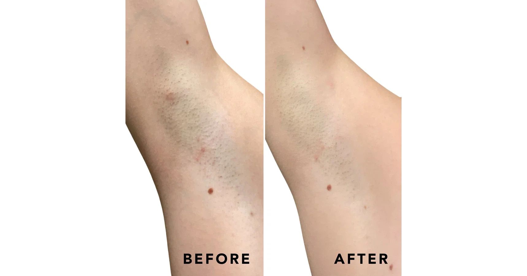 SweetSpot Buff & Brighten Body Exfoliating Pads (50 pads)